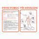 Pravidla první pomoci - První pomoc při krvácení